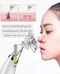 Acne Pore & Blackhead Remover Rechargeable